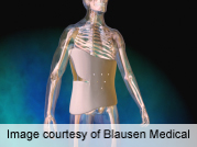 Teen girls dislike wearing a body brace, but parents worry most of all.