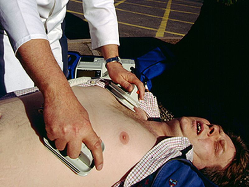 Will CPR Save Your Life? Study Offers a Surprising Answer