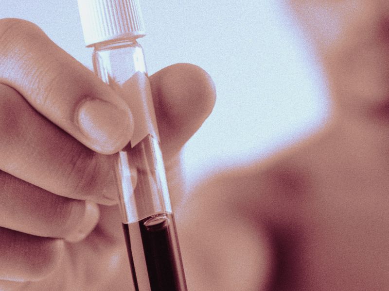Blood Test Might Spot Cancer Years Earlier