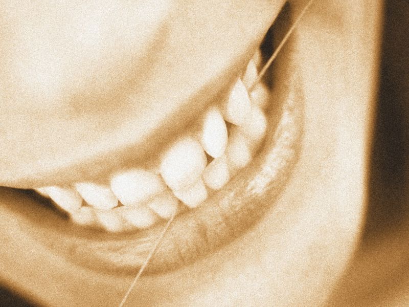 Keep Flossing: Study Ties Gum Disease to Higher Cancer Risk