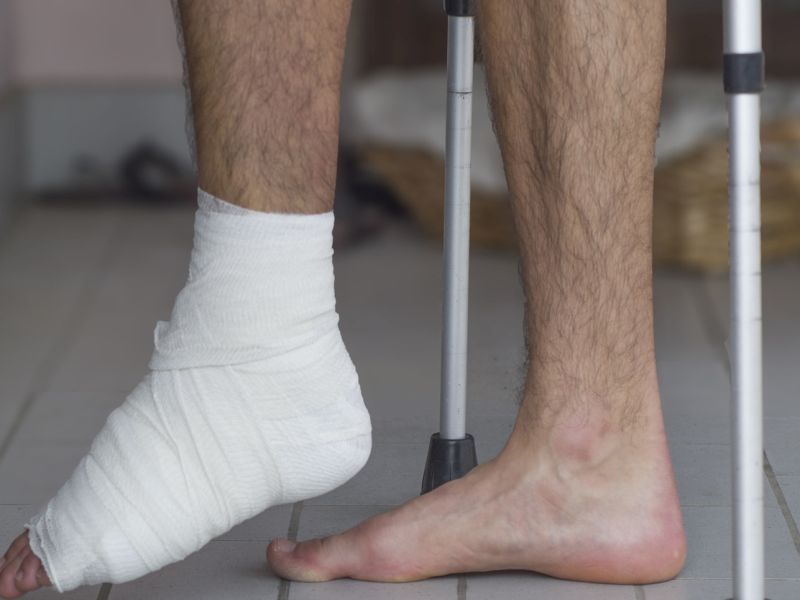 Ditch the Cast: Some Broken Ankles May Heal in Half the Time