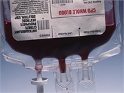 FDA Urges COVID-19 Survivors to Donate Plasma