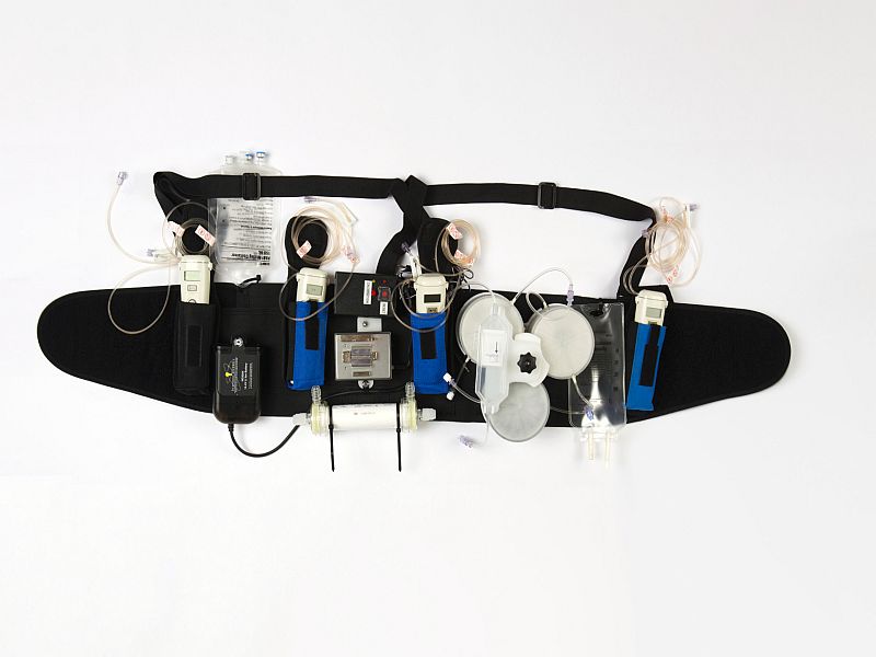 Coming soon A wearable artificial kidney?