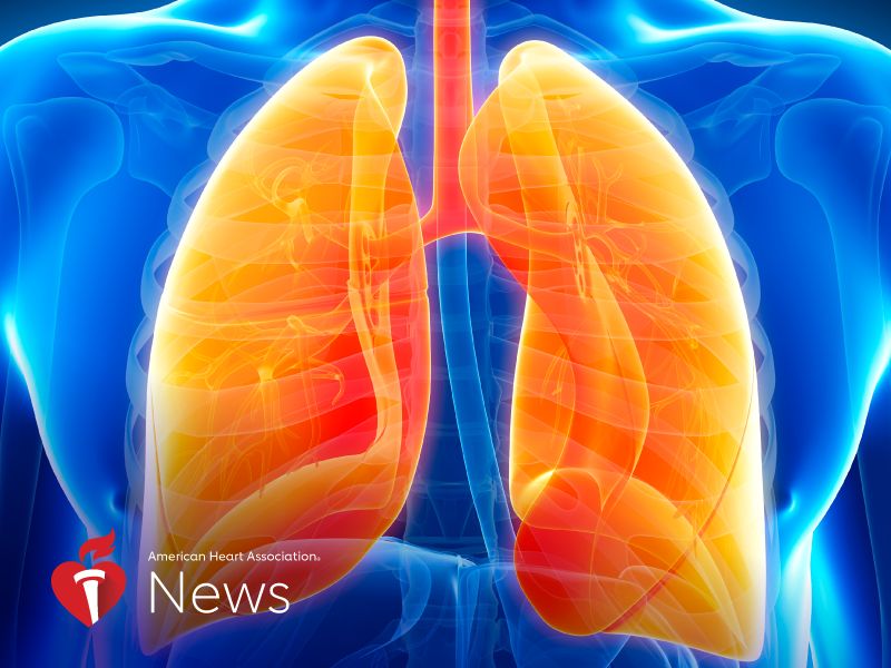 AHA News: Emphysema May Raise Risk of Ruptured Aneurysms