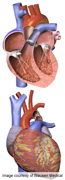News Picture: Could Flu Raise Risk of Fatal Artery Tear?