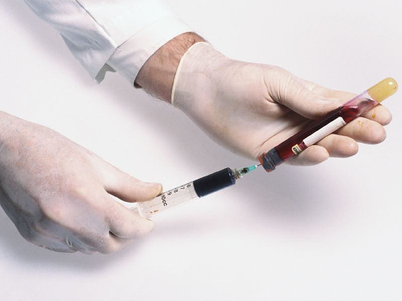 News Picture: Blood Test Might Predict When Antibiotics Won't Help