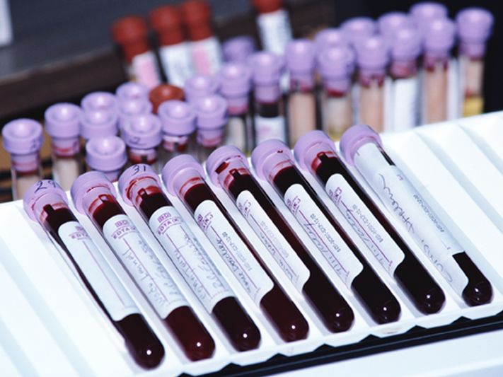 Your Blood Type May Predict Your Risk For Severe COVID-19