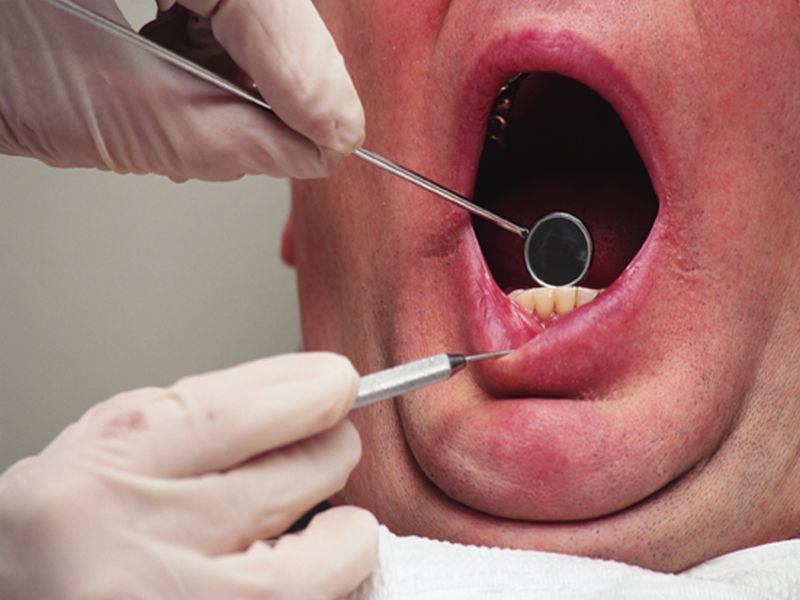 Dental Groups Push Back on WHO's Call to Delay Routine Care