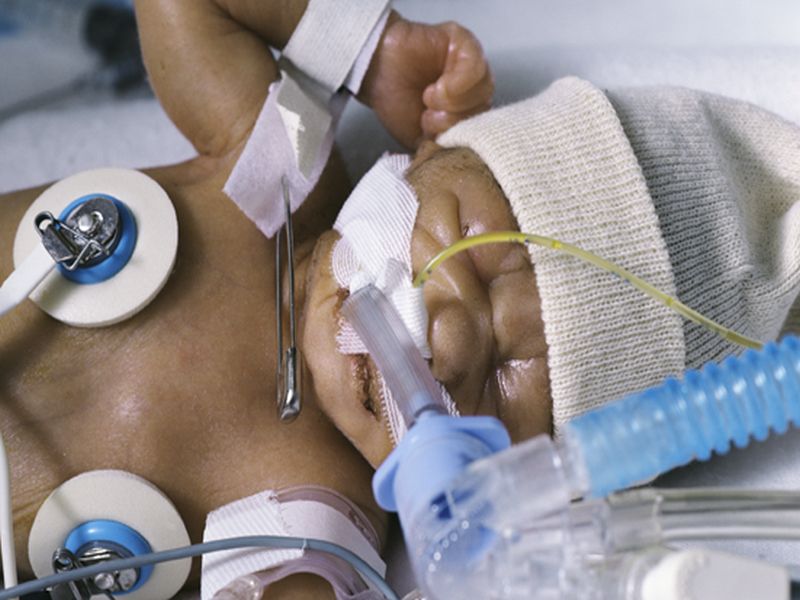 News Picture: U.S. Preemie Birth Rates Rise 2 Years in a Row