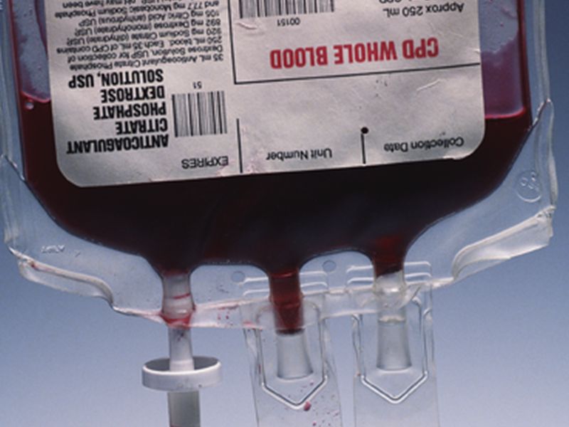 News Picture: U.S. Should Reinforce Blood Supply: Report