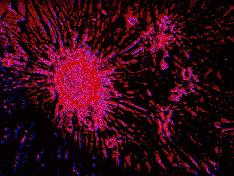 News Picture: In Mice, a Way for Stem Cells to Build Bone