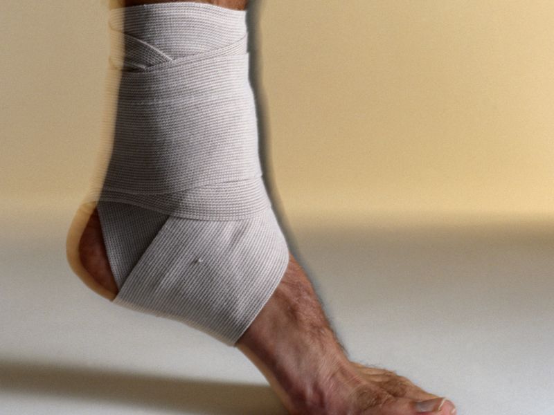 Sprained Ankle Could Pose Longer-Term Harms to Health