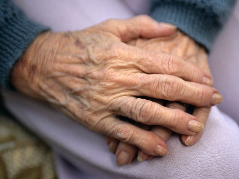 News Picture: 'Managing' Elderly Patients Without Powerful Antipsychotics