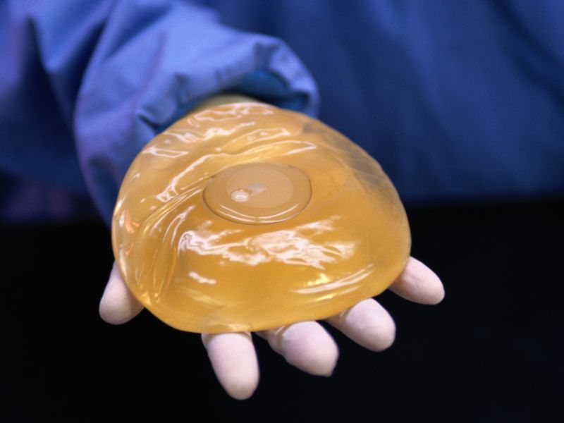News Picture: Few U.S. Women Know About Cancer That Develops Near Breast Implants: Study