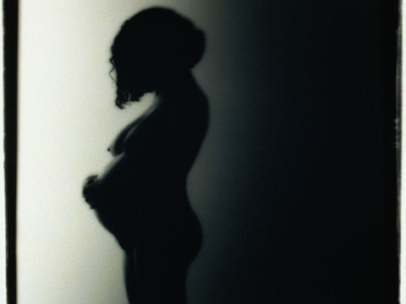 News Picture: Sharp Increase in U.S. Babies Born With Syphilis: CDC