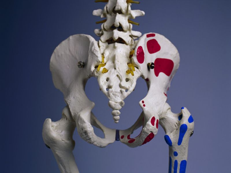 In Many Cases, Hip Replacement Also Eases Back Pain