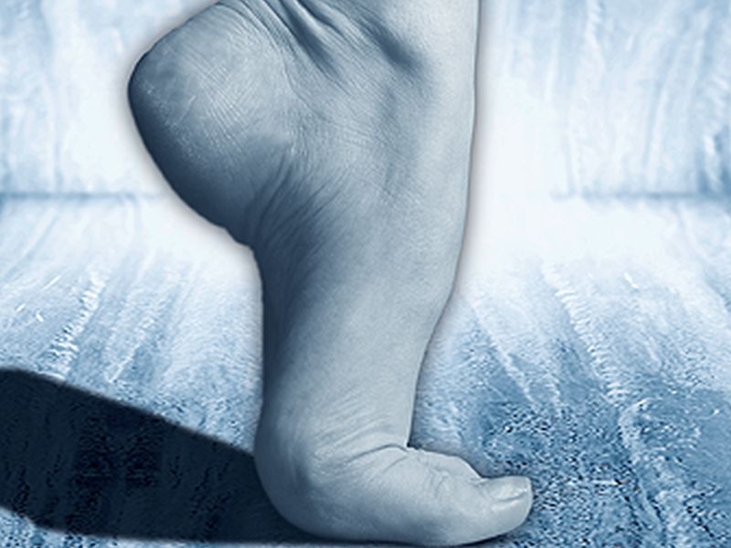Exercise Injury Prevention: Protecting Your Ankles