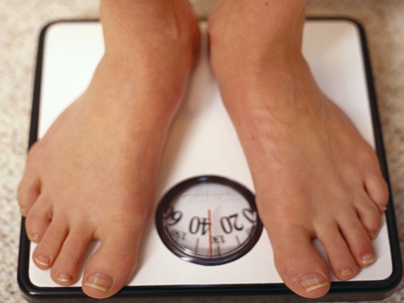 So You've Had Weight-Loss Surgery. Now What?