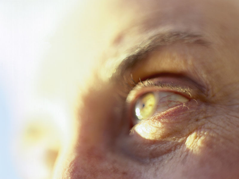 News Picture: Extra Calcium Safe for the Aging Eye