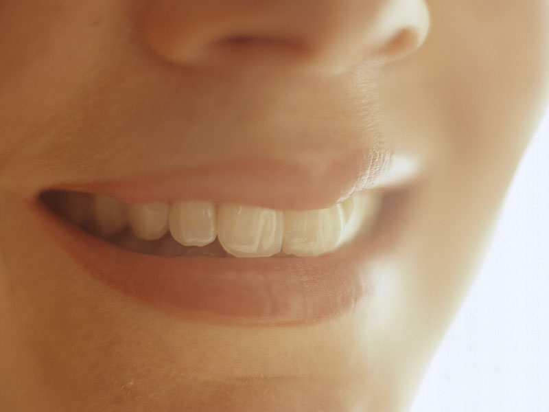 News Picture: Those Whitening Strips May Damage Your Teeth