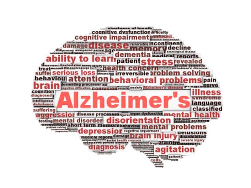 News Picture: Brain Plaques Signal Alzheimer's Even Before Other Symptoms Emerge: Study
