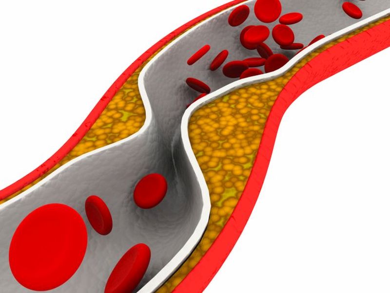 Fewer Americans Have High Cholesterol