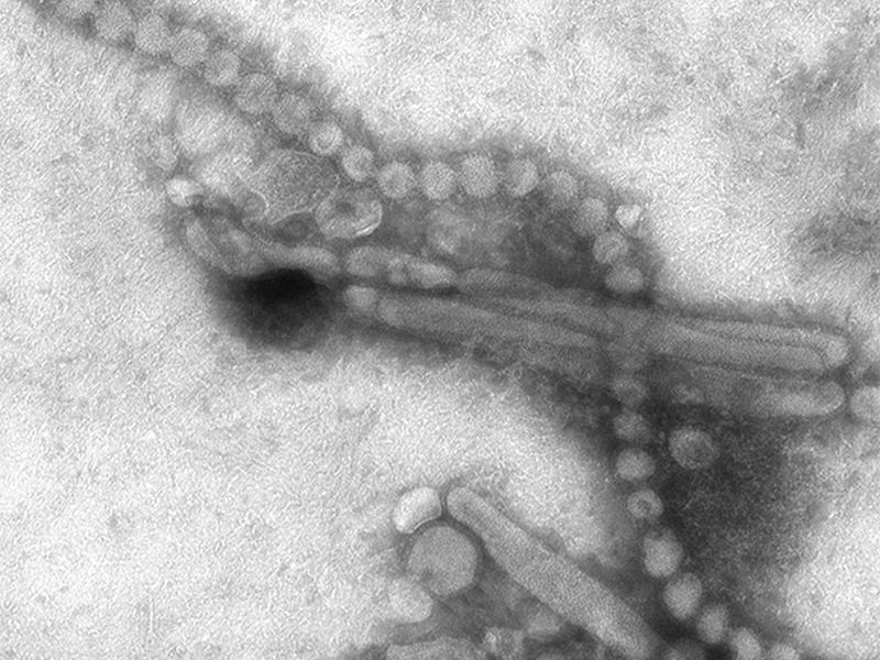 News Picture: Person-to-Person Bird Flu Transmission Likely Happened at Chinese Hospital