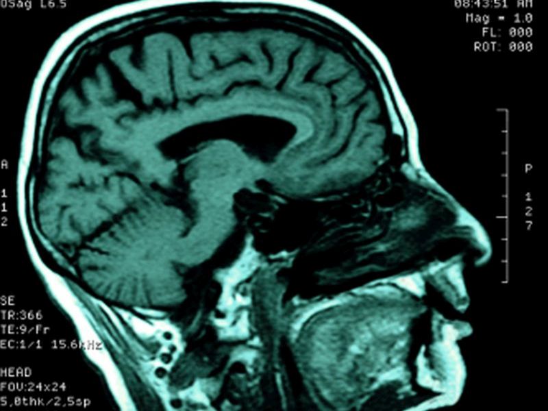 Only Spoken Words Processed in Newly Discovered Brain Region