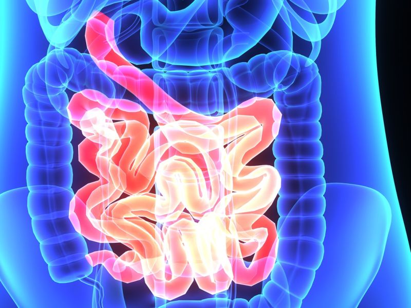 'Poop Transplants' May Help Ease Painful Colitis