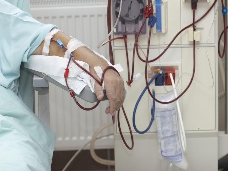 COVID-19 Takes Heavy Toll on Kidneys