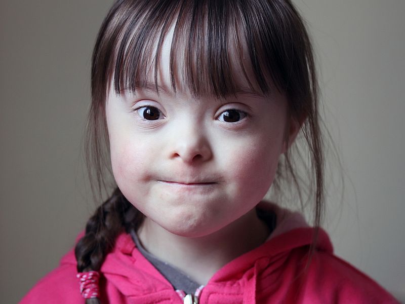 News Picture: Down Syndrome May Not Be Big Financial Burden on Families