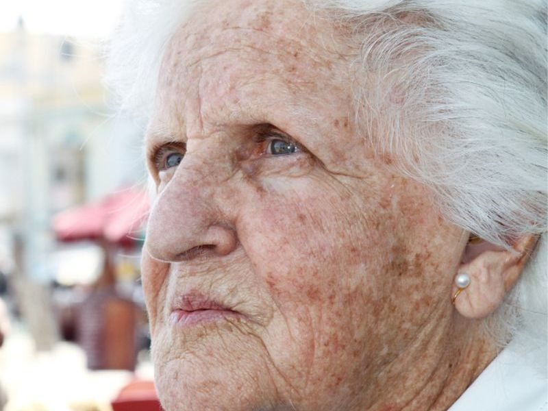 Clues to Why Women Have Higher Odds for Alzheimer's