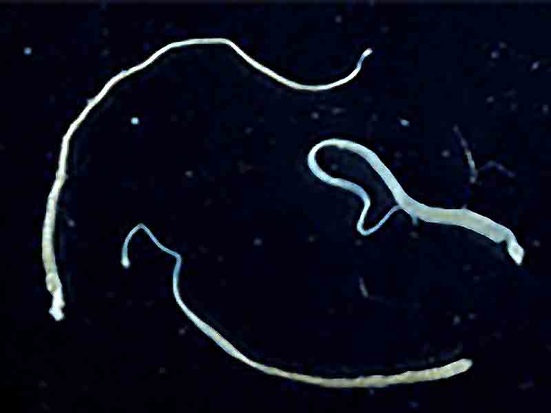News Picture: Tapeworm May Have Spread Cancer Cells to Colombian Man