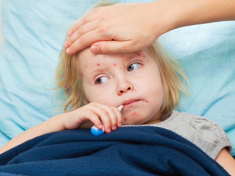 As U.S. Measles Cases Hit New High, Experts Warn the Disease Can Be Deadly