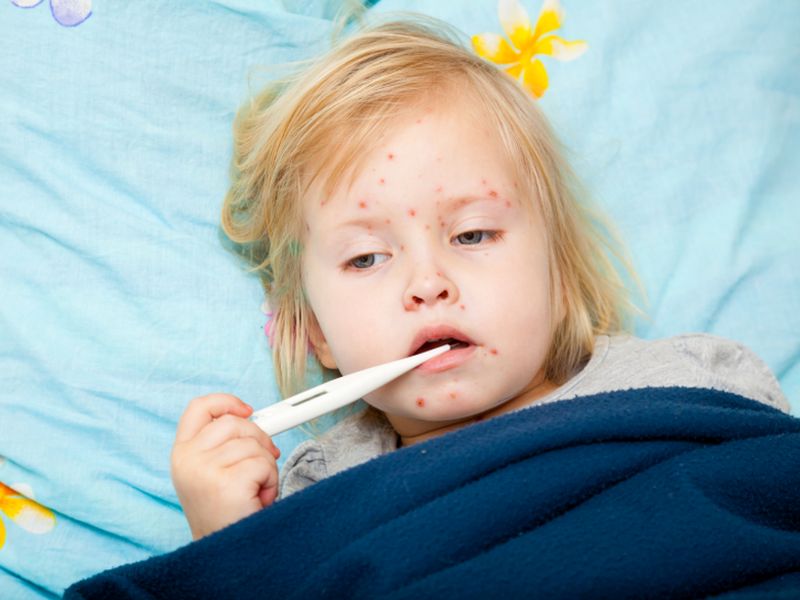 News Picture: Here's What Happened When 1 Unvaccinated NYC Kid Got Measles