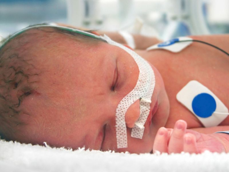 News Picture: Exposure to Iodine in the NICU May Affect Infant Thyroid Function