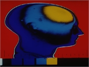 CDC: Nearly Half of TBI-Related Deaths Categorized as Intentional