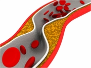 Cholesterol Levels Have Been Dropping Since 2013 Guidelines