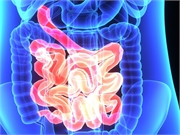 High-Risk Patients Not Aware of Needed Colonoscopy Intervals