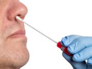 Self-Collected Nasal Swabs Acceptable for SARS-CoV-2 Testing