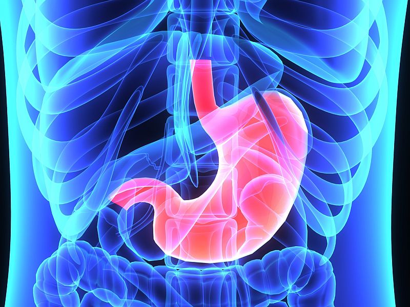 Stomach Cancer Appears Different in Younger Patients