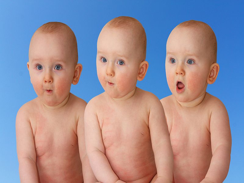 News Picture: Births of Triplets, Quadruplets on Decline in U.S.: Report