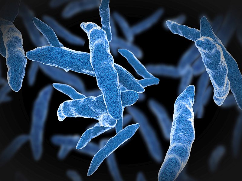 Imagen de noticias: La disminución de la tuberculosis en EE. UU. se estancó, informan los CDC