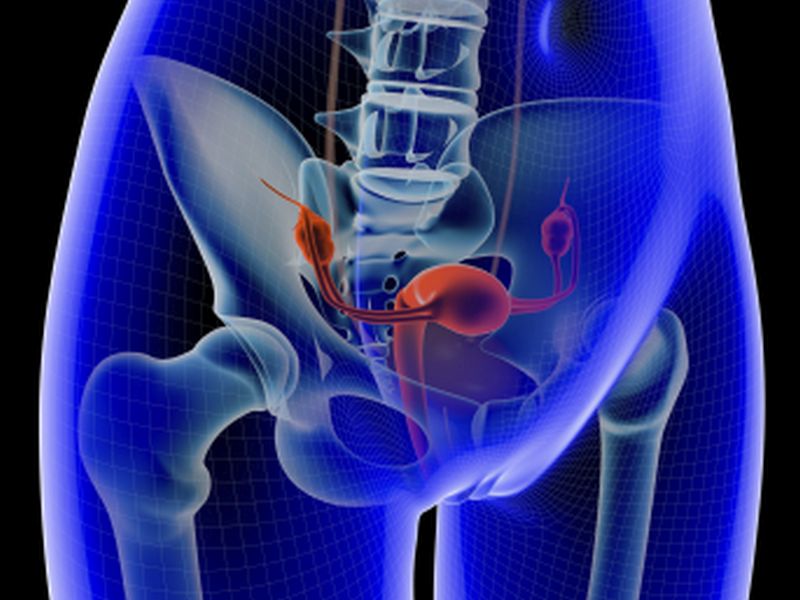 Less Invasive Fibroid Treatment May Work as Well as Surgery