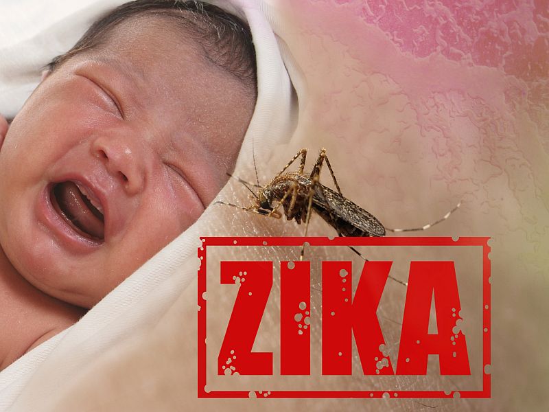 Zika's Damage Continues in Children Infected Before Birth