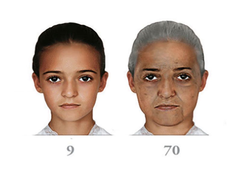 Age 9 to 70 UV exposure damage